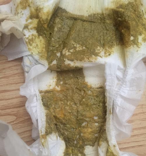七个月宝宝拉肚子怎么办（宝宝拉肚子原因及急救方法）  第2张