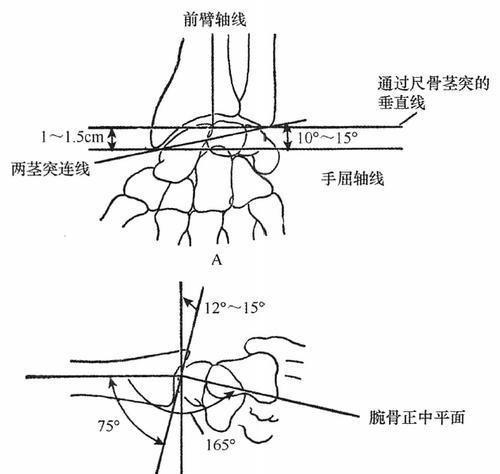 肩膀韧带拉伤的治疗与护理（了解肩膀韧带拉伤的原因及正确处理方法）  第3张