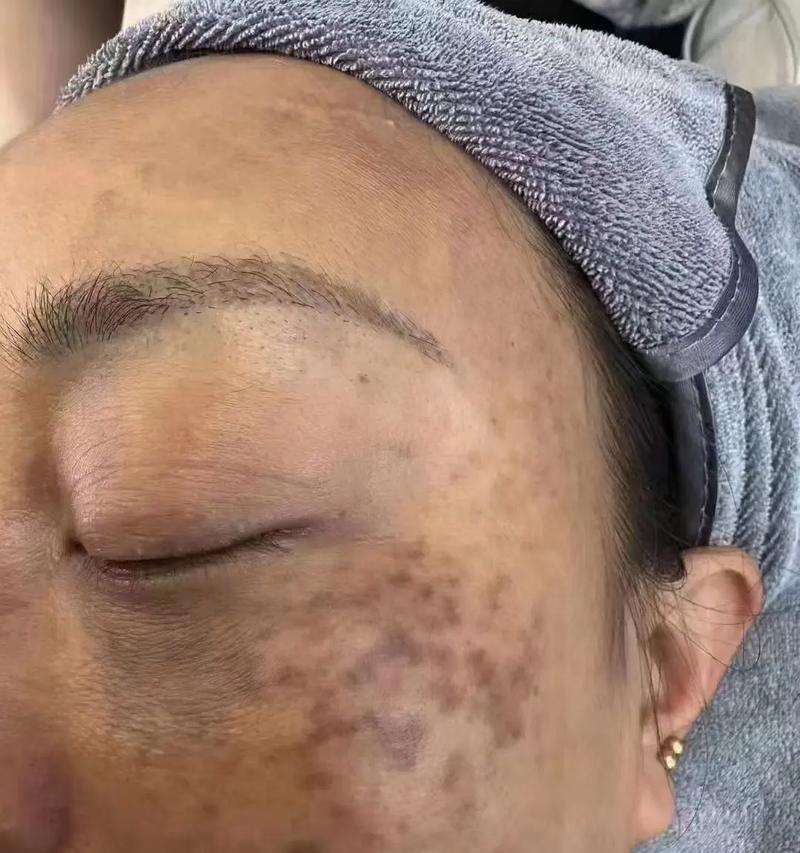 手机拍照斑影问题如何处理？  第2张