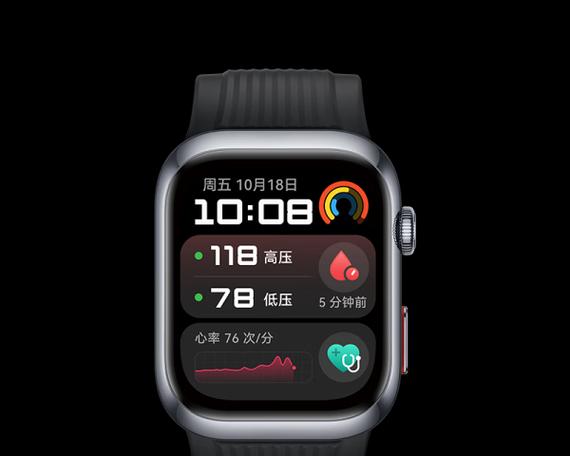 女士智能手表哪个品牌更值得购买？  第2张